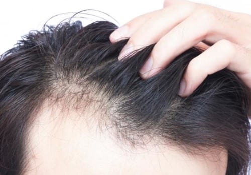 Does hair grow back after nutrient deficiency?