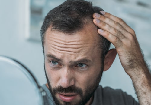 Can hair regrow if it lost due to lack of nutrients?
